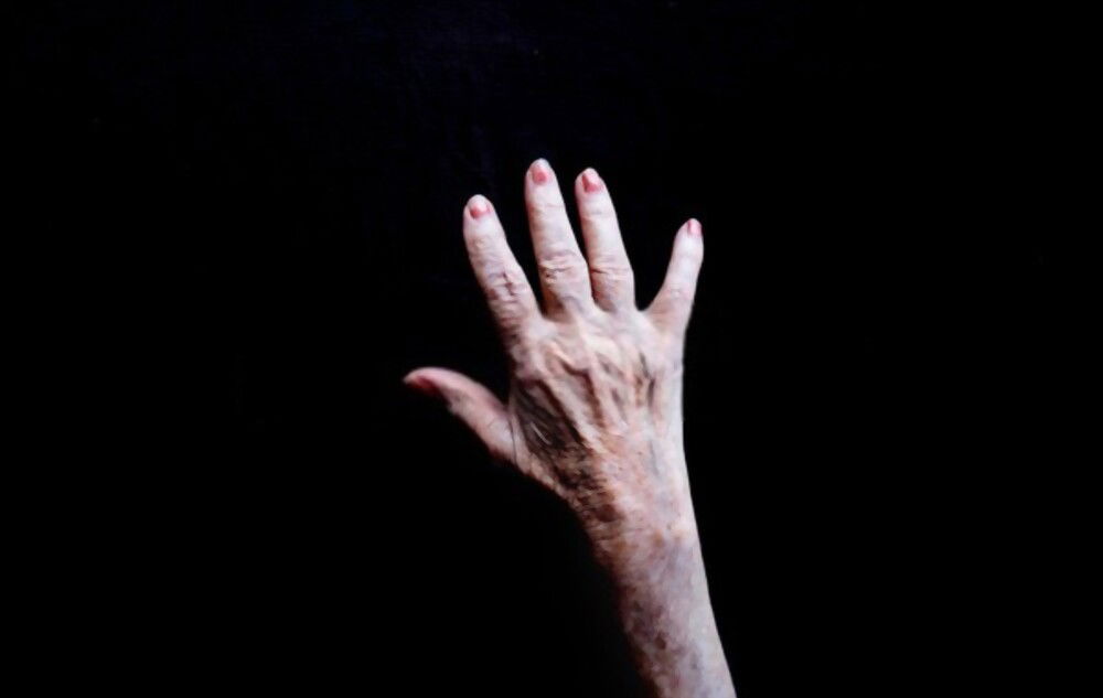 Do You Have Veiny Hands? Here’s Why &Amp; What It Means! 1 607Dbee57Cf7F 1