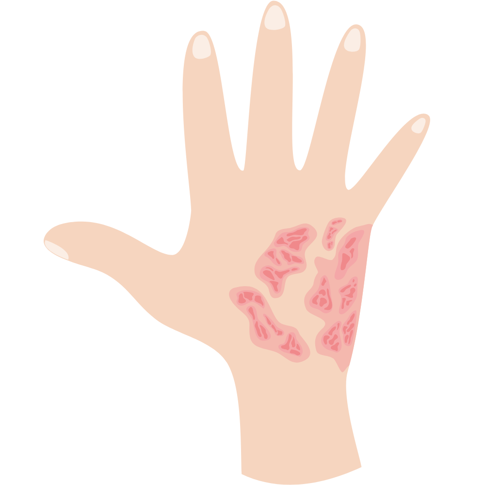 Turmeric (Kasturi Manjal) soap – natural soap that helps heal skin infections and promotes healthy skin