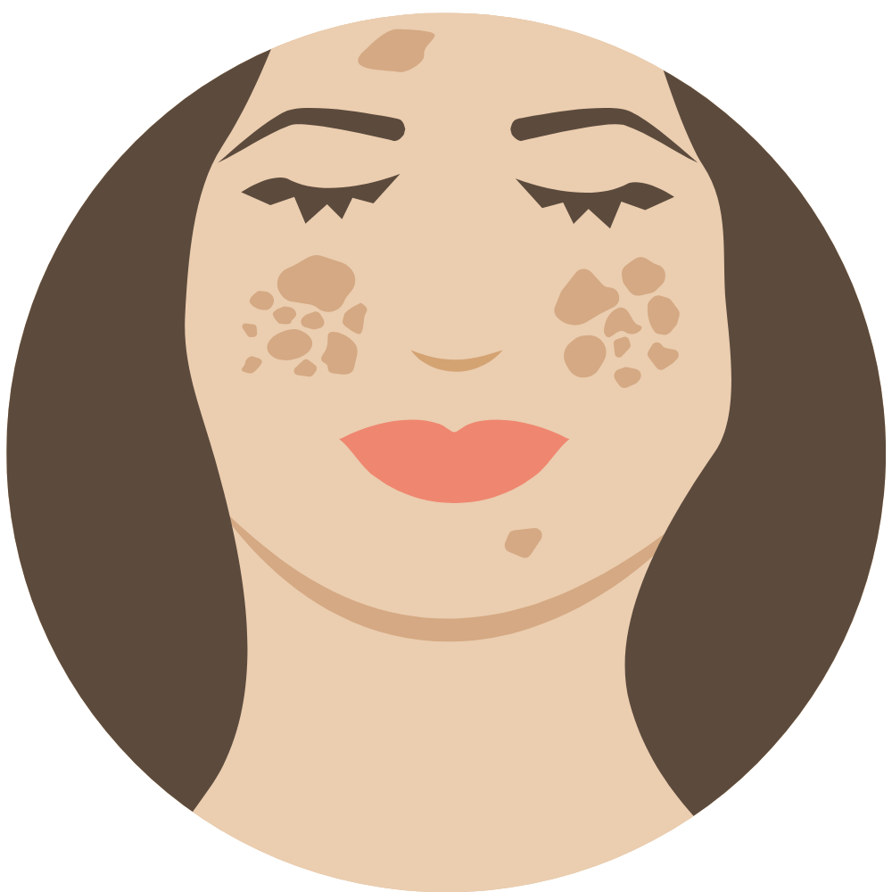 Product that reduces dark spots on skin" "Helps fade dark spots and uneven skin tone"