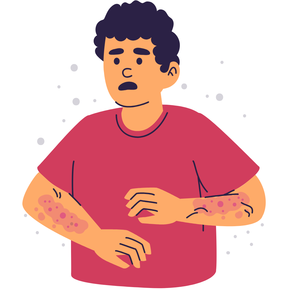 Skin care product that prevents skin allergies