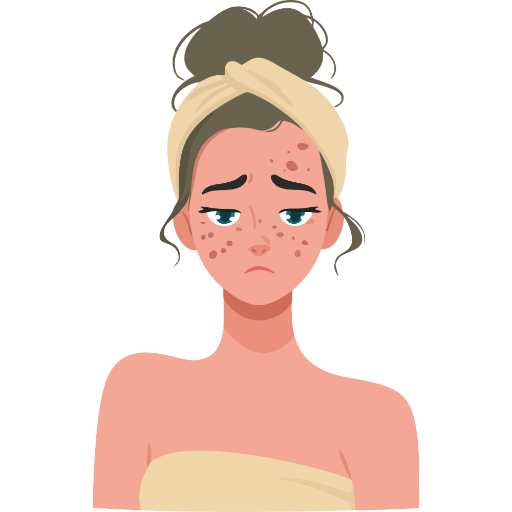 “Helps in preventing pimples and maintaining clear skin” “Natural formula that controls excess oil and prevents pimples”