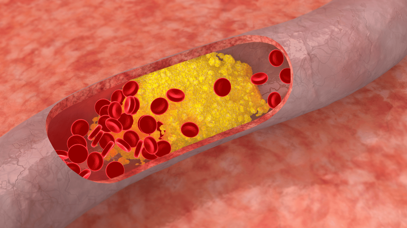 நல்லெண்ணெயில் உள்ள லெசித்தின் மற்றும் லினோலிக் அமிலம் இரத்தத்தில் கெட்ட கொழுப்பை (Ldl) கரைத்து நல்ல கொழுப்பின் (Hdl) அளவை அதிகரிக்கும் செயல்முறை விளக்கம்.
